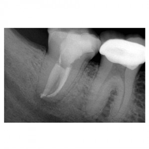 6 post op 24