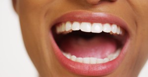 'Woman Opening Mouth' 'Periodontal Disease'